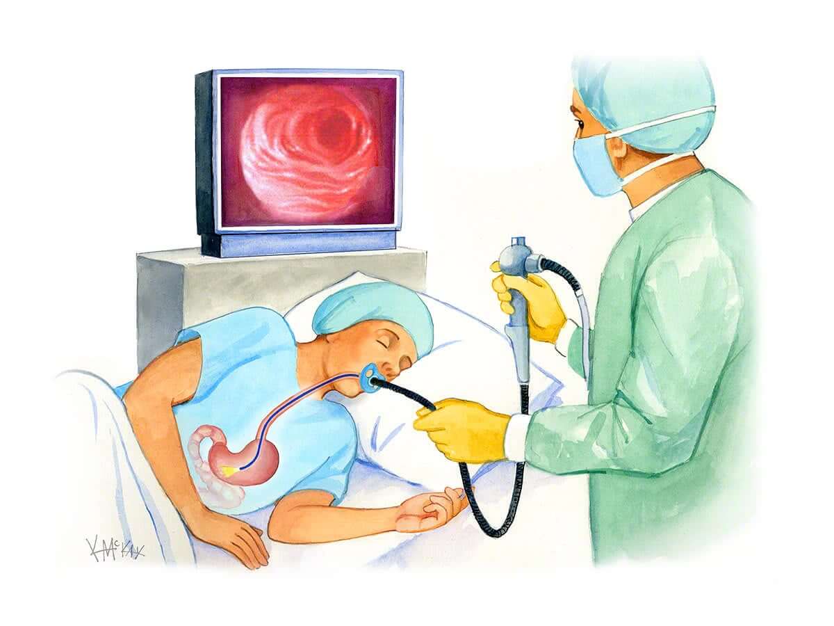 New England Surgical Tamworth gastroscopy
